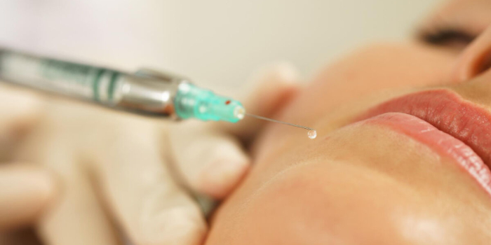 Anvisa alerta para riscos de uso indevido de preenchedores dérmicos